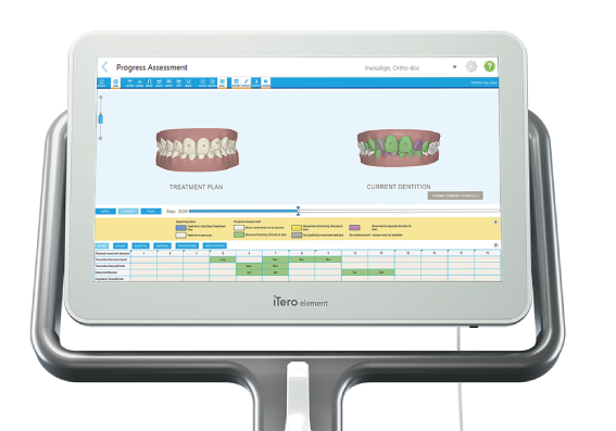 インビザラインとその他矯正方法との比較